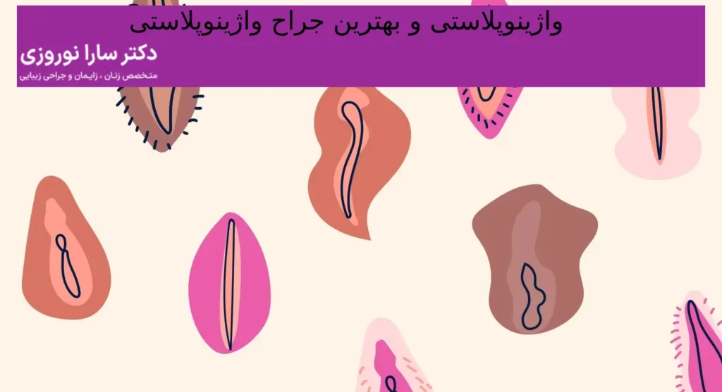 واژینوپلاستی و بهترین جراح واژینوپلاستی