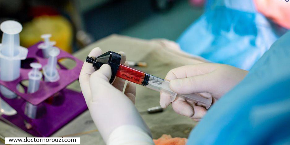 تزریق چربی به لابیاها