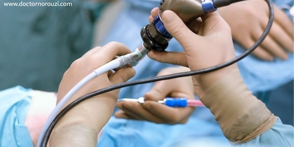 لاپاراسکوپی