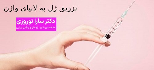 تزریق ژل به لابیای واژن