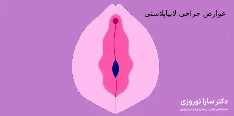 عوارض جراحی لابیاپلاستی