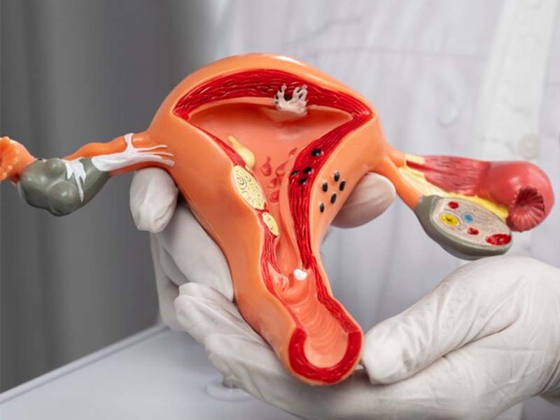 لابیاپلاستی با لیزر در تبریز