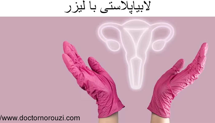 لابیاپلاستی با لیزر