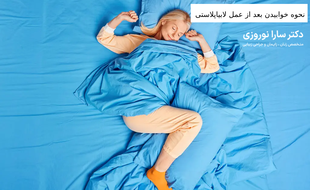 نحوه خوابیدن بعد از عمل لابیاپلاستی