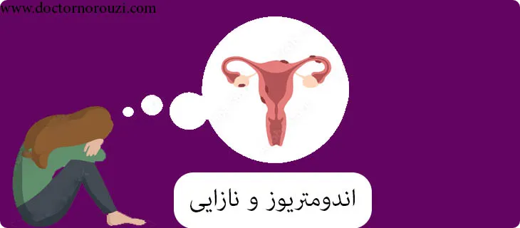 اندومتریوز و نازایی