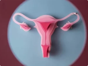 انواع درمان اندومتریوز