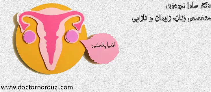 تفاوت لابیاپلاستی لیزر و جراحی