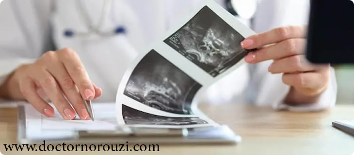سونوگرافی اندومتریوز چیست