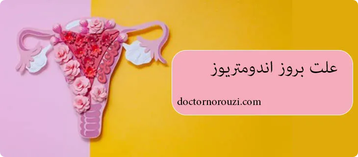علت اندومتریوز