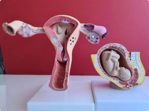 اندومتریوز در سزارین