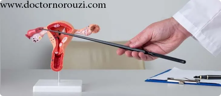 عوارض هیستروسکوپی چیست