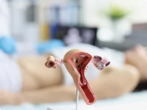 مراقبت‌‌های بعد از هیستروسکوپی 