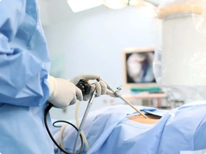 بهترین دکتر لاپاراسکوپی