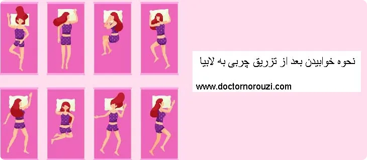 بهترین نحوه خوابیدن بعد از تزریق چربی به لابیا