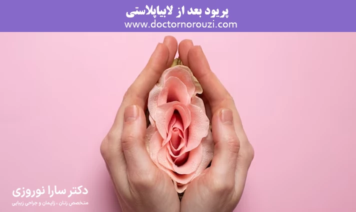 پریود بعد از لابیاپلاستی