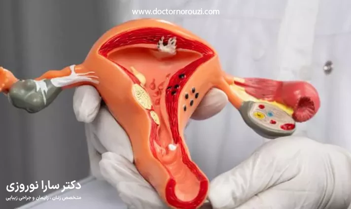 مزایای تنگ کردن واژن بعد از زایمان