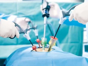 خطرات شروع زودهنگام رابطه جنسی بعد از لاپاراسکوپی