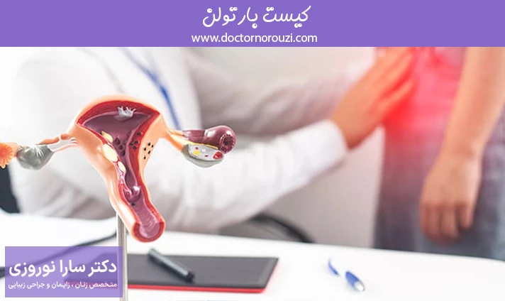 کیست بارتولن