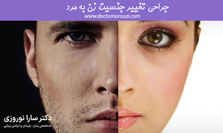 جراحی تغییر جنسیت زن به مرد