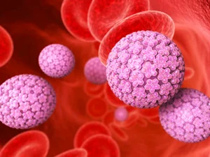 علل بروز زگیل تناسلی