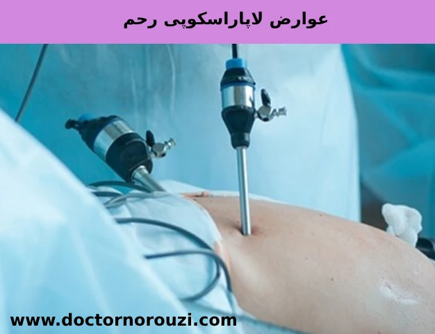 عوارض لاپاراسکوپی رحم