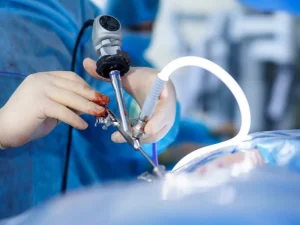 پیشگیری از عوارض لاپاراسکوپی رحم