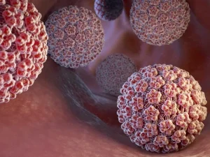 درمان ویروس hpv