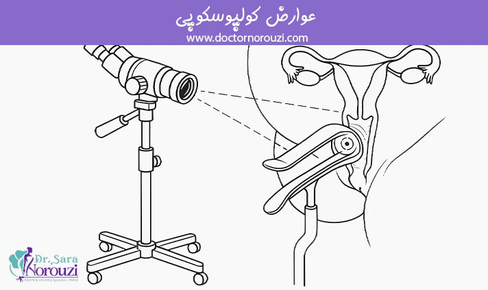 عوارض کولپوسکوپی
