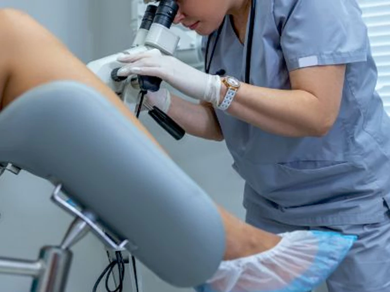 مراقبت های قبل و بعد از کولپوسکوپی زگیل تناسلی